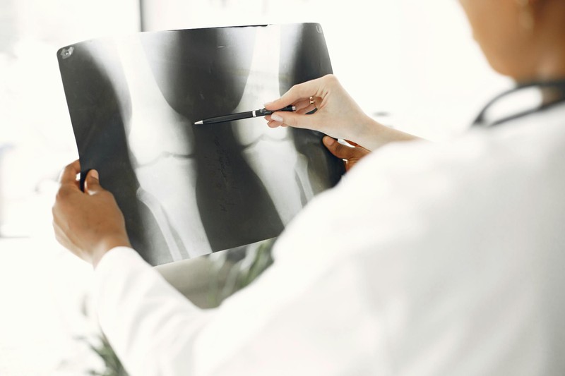 A medical professional in a white coat examines a leg X-ray, pointing at details with a pen