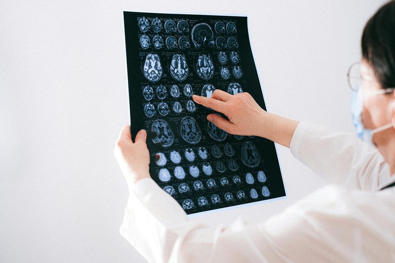 A doctor in a white coat and face mask examines a sheet of brain MRI scans