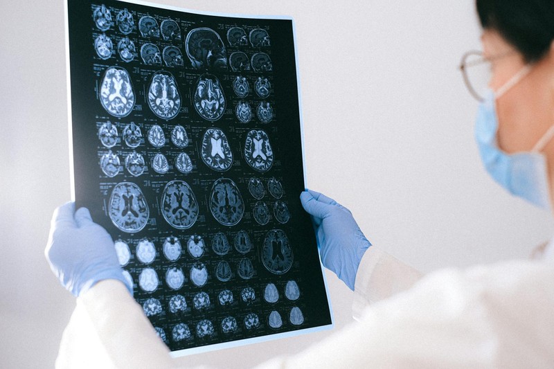 A medical professional in a white lab coat, surgical mask, and gloves examines a sheet of MRI brain scans in a clinical setting