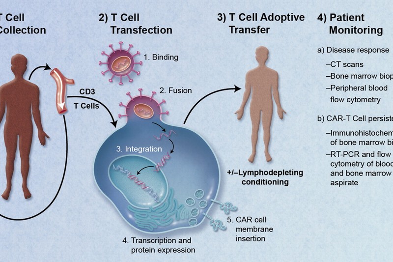Scientific diagram illustrating the four steps of CAR T-cell therapy: T cell collection, transfection, adoptive transfer, and patient monitoring