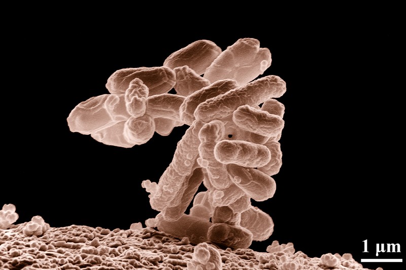 Colorized electron micrograph of a cluster of E. coli bacteria magnified 10,000 times