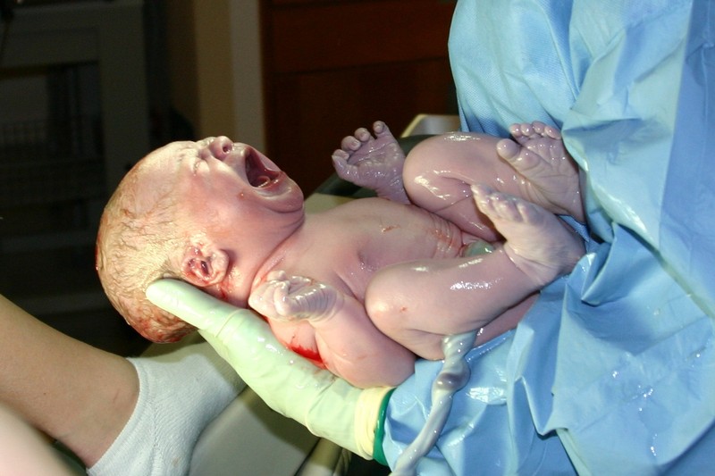 A newborn infant cries moments after birth, held by gloved medical hands in a hospital delivery room