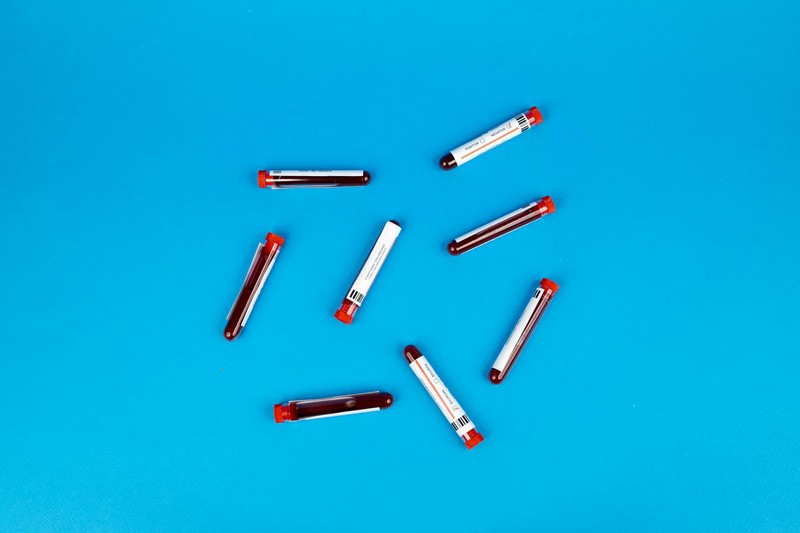 Blood sample collection tubes with red caps arranged on a vivid blue background
