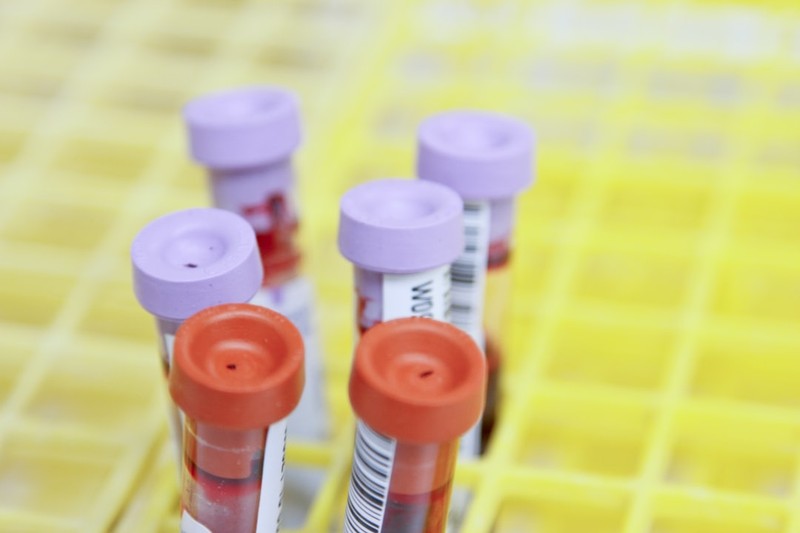 Blood sample collection tubes in a laboratory rack, with purple and orange capped vials containing blood specimens.