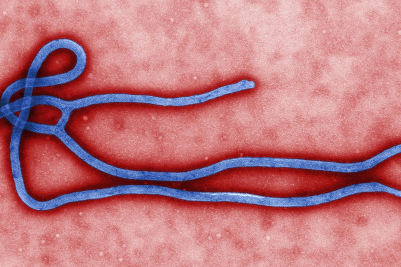 Colorized transmission electron micrograph of an Ebola virus virion showing its characteristic filamentous shape