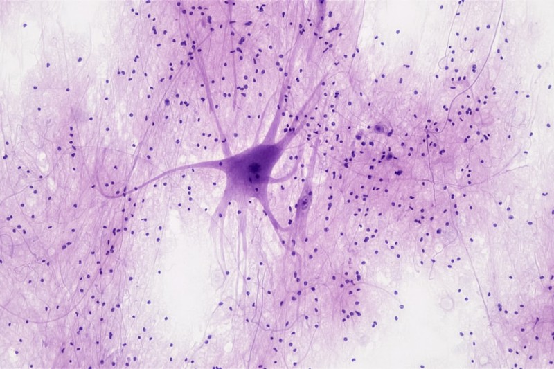 Microscope image of a stained neuron showing the cell body and branching dendrites